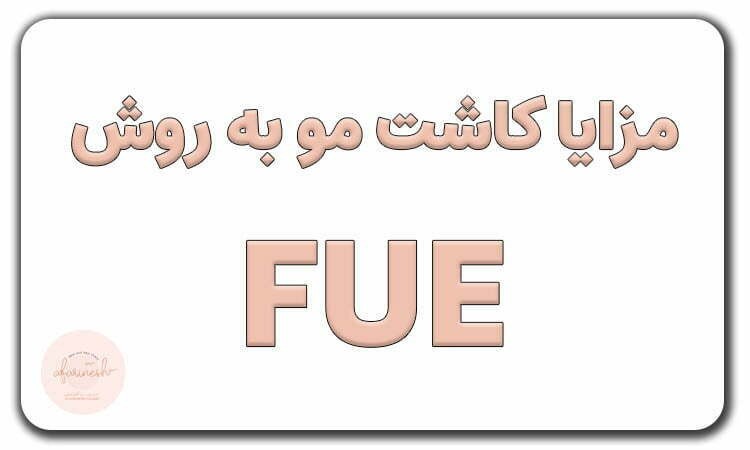 مزایا کاشت مو به روش FUE