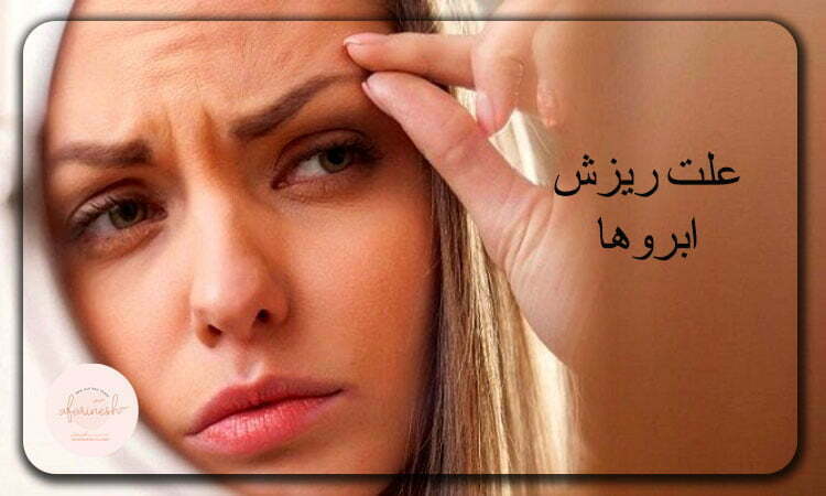 دلایل ریزش ابرو