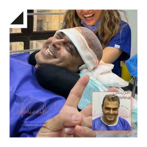 کاشت مو آفرینش