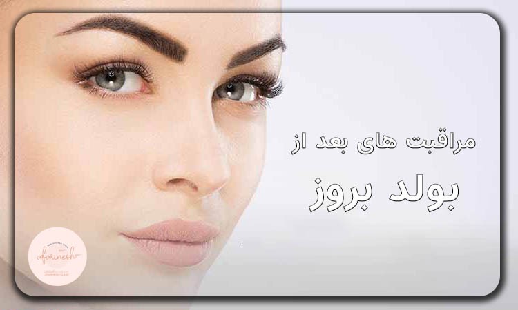 مراقبت های بعد از بولد بروز