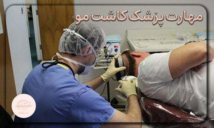 مهارت پیشرفته پزشک کاشت مو