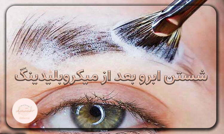 چند روز بعد از میکروبلیدینگ میتوان صورت را شست