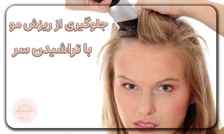 تراشیدن سر برای جلوگیری از ریزش مو