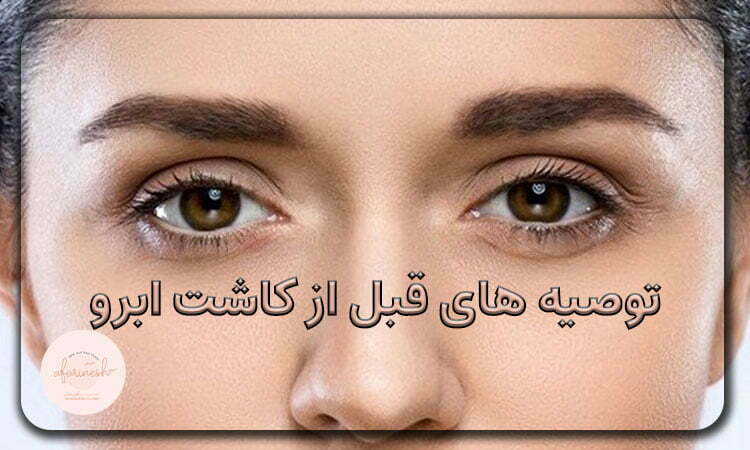 مراقبت های قبل از کاشت ابرو