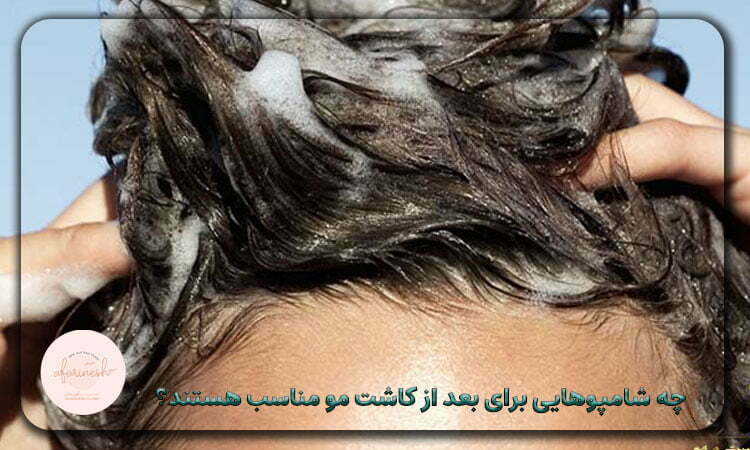 بهترین شامپو بعد از کاشت مو چیست؟