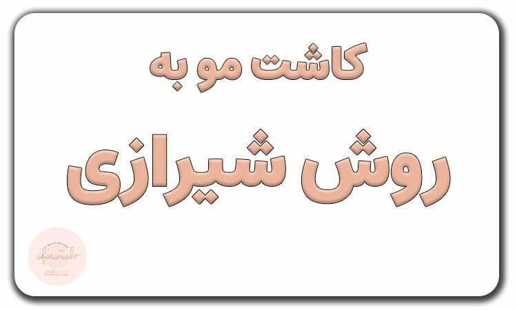 کاشت مو به روش شیرازی