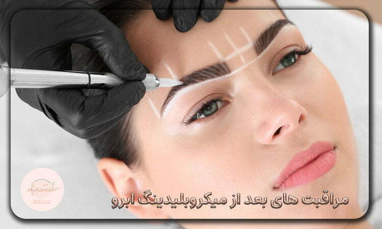 مراقبت بعد از انجام عمل میکروبلیدینگ ابرو