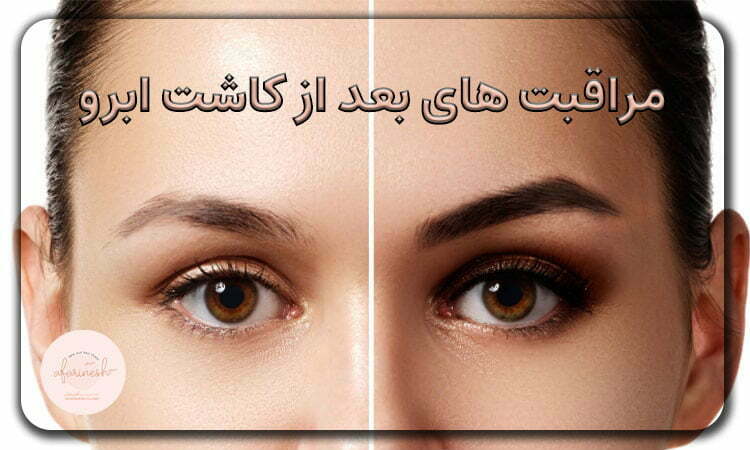 مراقبت های قبل از کاشت ابرو
