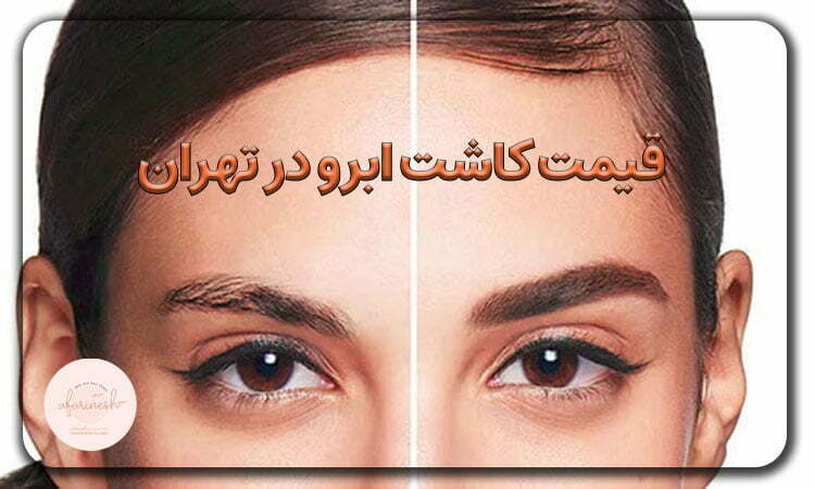 قیمت کاشت ابرو در تهران