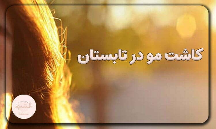 کاشت مو در تابستان