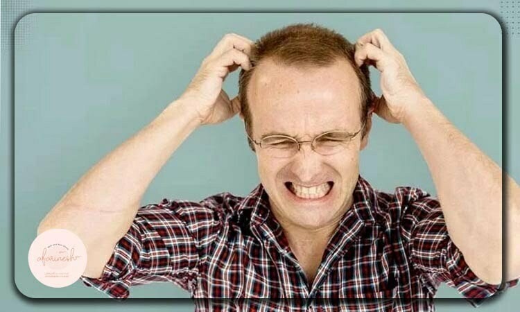 خارش بعد از کاشت مو