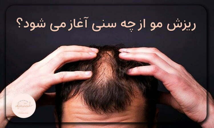 ریزش مو از چه سنی آغاز می شود؟