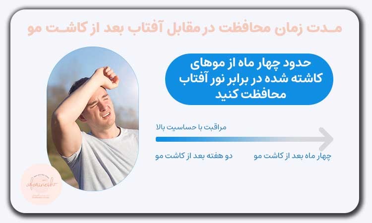 مدت زمان محافظت در مقابل نور آفتاب بعد کاشت مو
