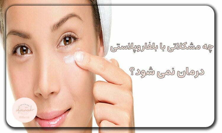 چه مشکلاتی با عمل بلفاروپلاستی درمان نمی شود؟
