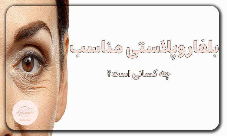 بلفاروپلاستی مناسب چه اشخاصی است؟