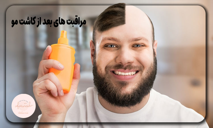 مراقبت های بعد از کاشت مو به روش fut