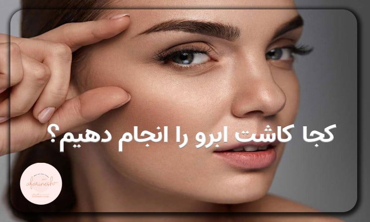 کاشت ابرو