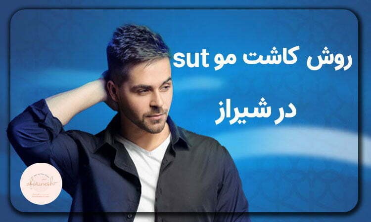 روش کاشت مو SUT