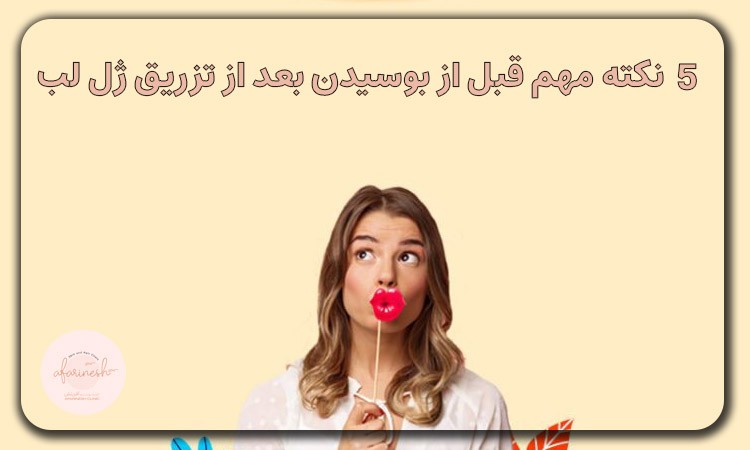نکات مهم قبل از بوسیدن و بعد از تزریق ژل لب