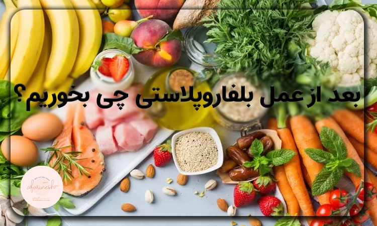 بعد از عمل بلفاروپلاستی چی بخوریم؟