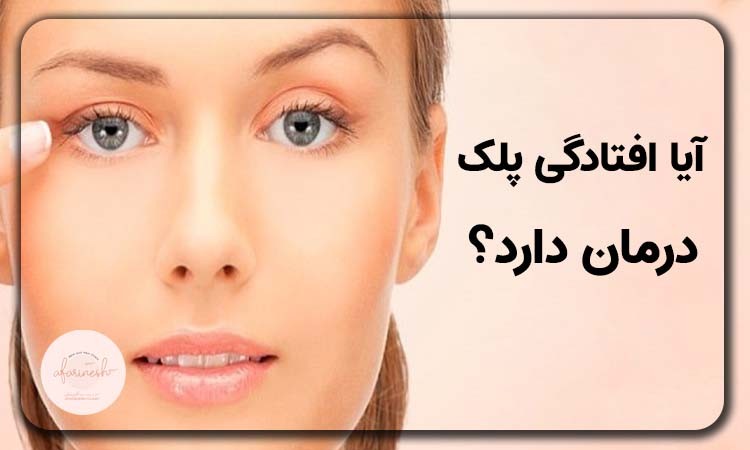 آیا افتادگی پلک درمان دارد؟
