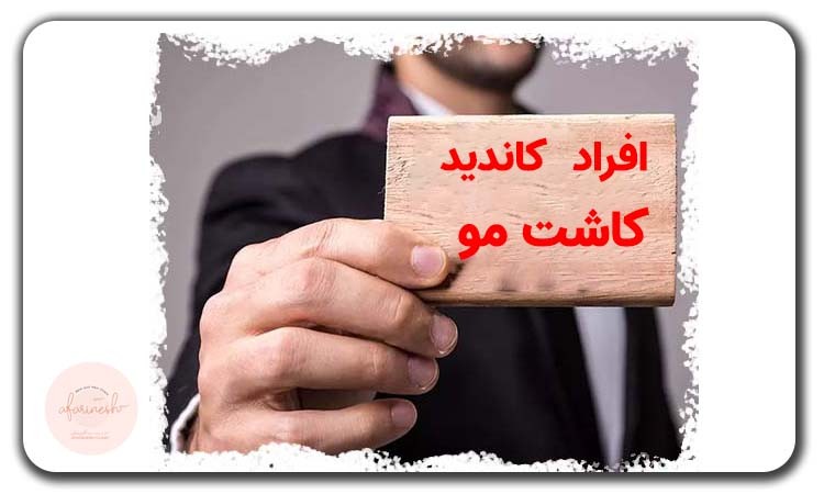 چه اشخاصی مناسب کاشت مو نیستند؟