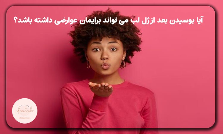 بوسیدن بعد از ژل لب