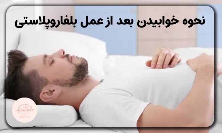 نحوه خوابیدن بعد از عمل بلفاروپلاستی