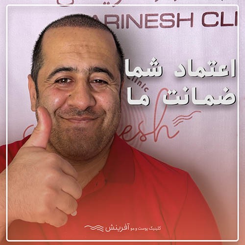 نظر درباره کاشت مو در کلینیک آفرینش