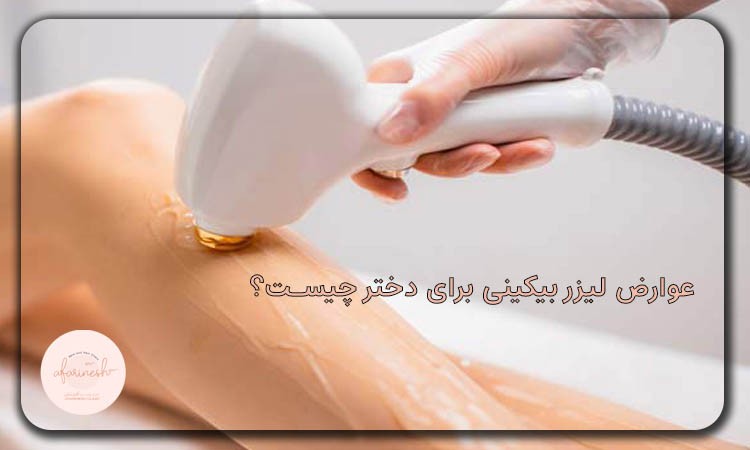 عوارض لیزر بیکینی یا بدن برای دختر