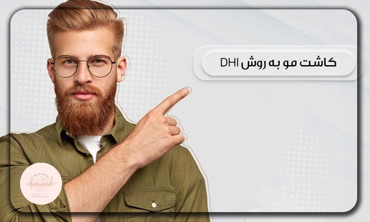 کاشت مو به روش DHI