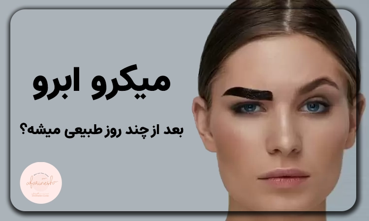 میکرو ابرو بعد از چند روز طبیعی میشه؟