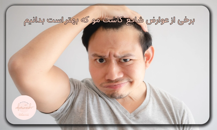عوارض کاشت مو