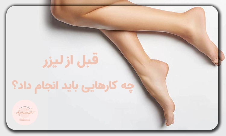 قبل از لیزر چه کنیم؟