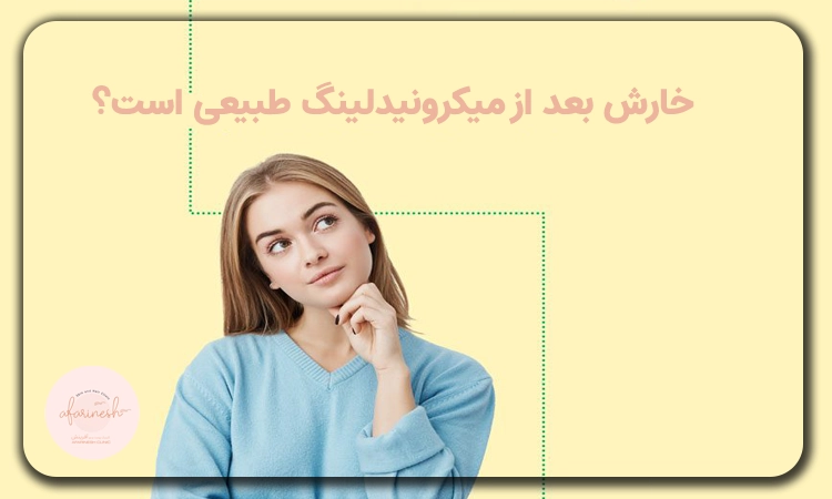 خارش بعد از میکرونیدلینگ