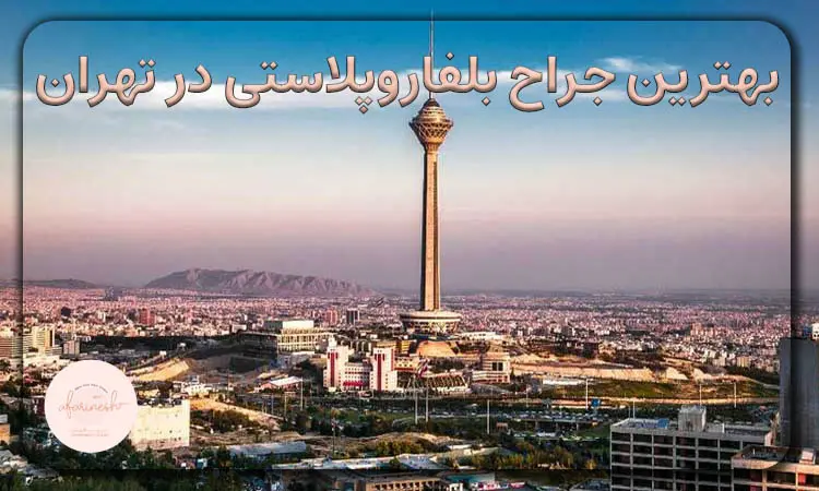 بهترین جراح بلفاروپلاستی در تهران