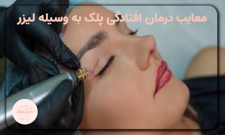 معایب درمان افتادگی پلک به کمک لیزر