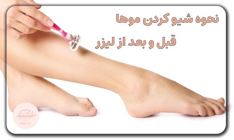 نحوه شیو کردن موها قبل و بعد لیزر