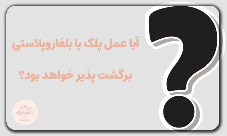 آیا بلفاروپلاستی دائمی است؟