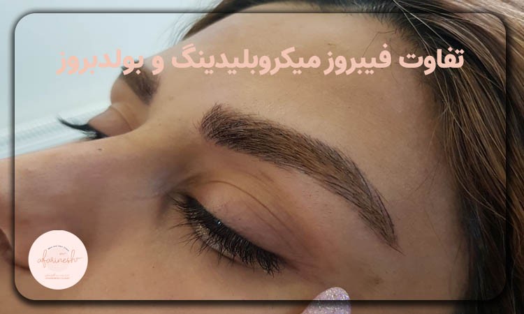 تفاوت فیبروز میکروبلیدینگ و بولدبروز چیست؟