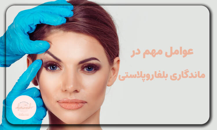 عوامل مهم در ماندگاری بلفاروپلاستی چه چیزهایی هستند؟