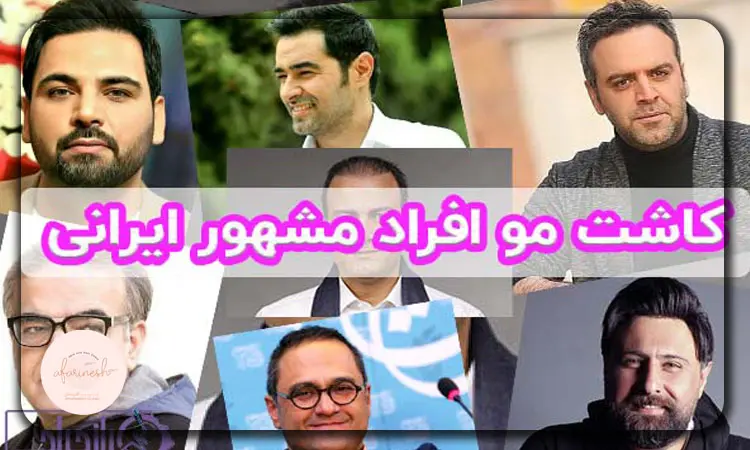 کاشت مو افراد مشهور ایرانی
