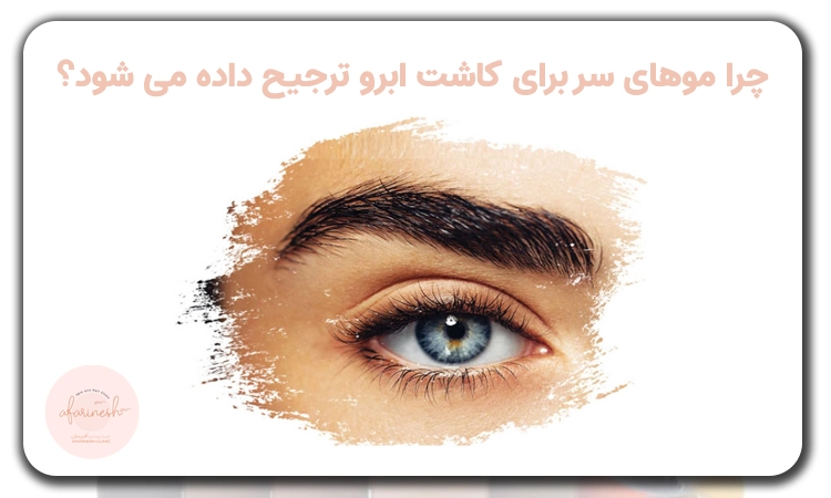 دلیل برش پشت سر برای کاشت ابرو چیست؟