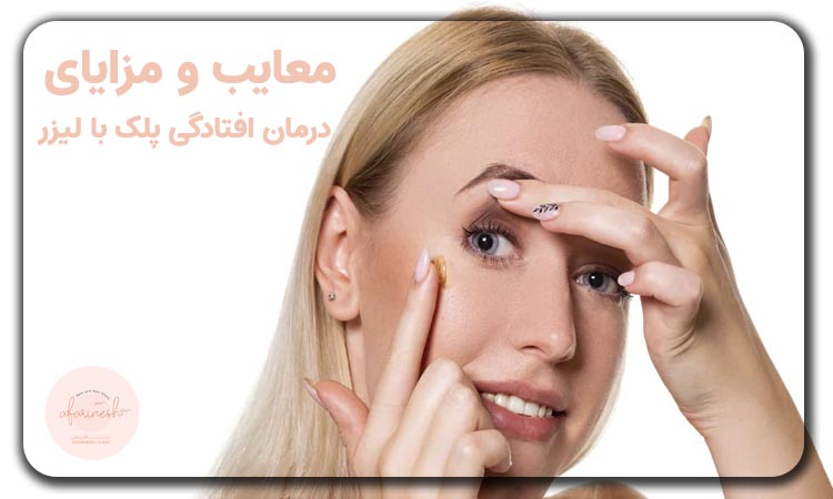 معایب مزایای درمان افتادگی پلک با لیزر