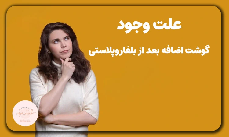 وجود گوشت اضافه بعد از بلفاروپلاستی