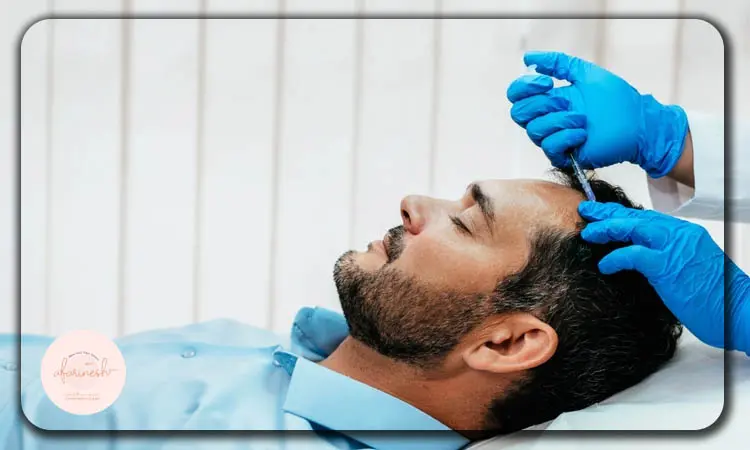 اقدامات بعد از مزوتراپی بعد از کاشت مو