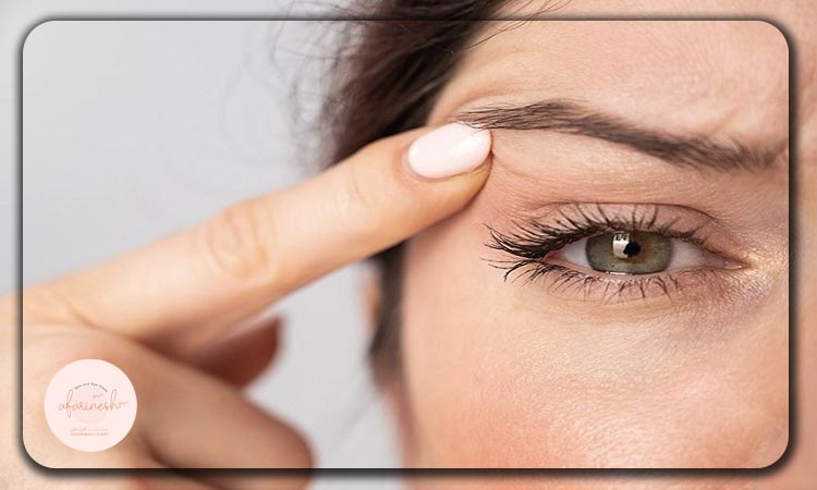 افتادگی پلک عصبی نشانه چه بیماری هایی می باشد؟
