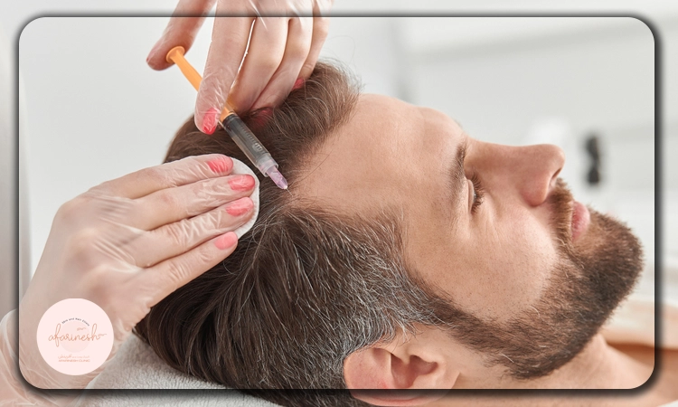 مزوتراپی چطور انجام میشود؟