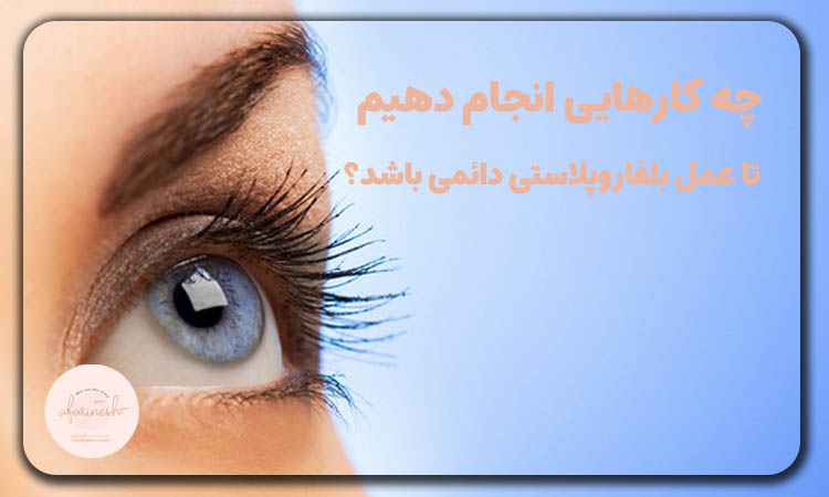 چه کارهایی انجام دهیم تا بلفاروپلاستی دائمی باشد؟