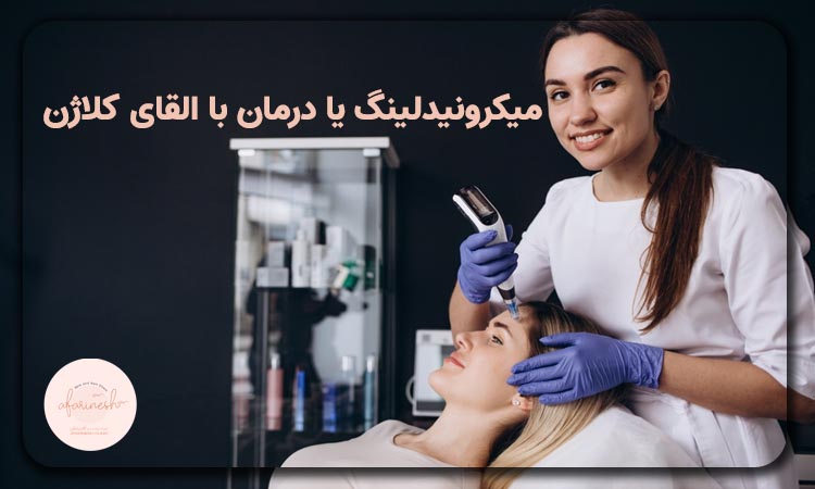میکرونیدلینگ یا درمان القای کلاژن